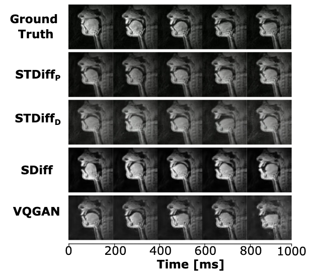 Publication thumbnail for the Medical Image Analysis vocal tract MRI paper